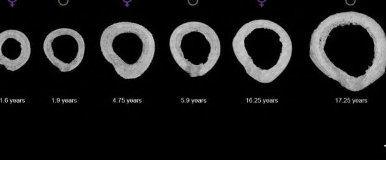人类学家发现女性骨骼在分娩后永久改变的新方法