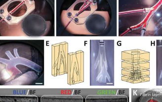 研究人员将古老的成型技术转向3D打印载有细胞的血管模型