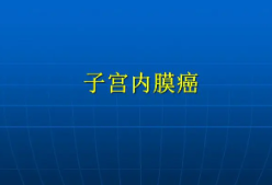 研究确定了治疗子宫内膜癌的新治疗策略