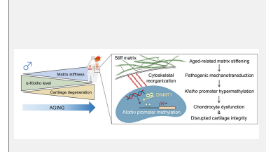 发现骨关节炎背后的新机制可以为新疗法提供信息