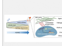 发现骨关节炎背后的新机制可以为新疗法提供信息