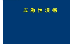 应激性溃疡的发病机制