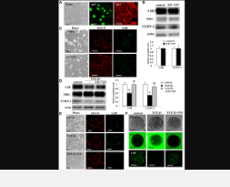 angulin1 LSR下调诱导肺腺癌恶性