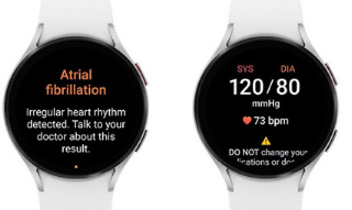 三星将发布搭载AFib通知技术的GalaxyWatch6和GalaxyWatch6Pro