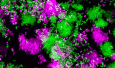 科学家发现调节细菌感染的小RNA