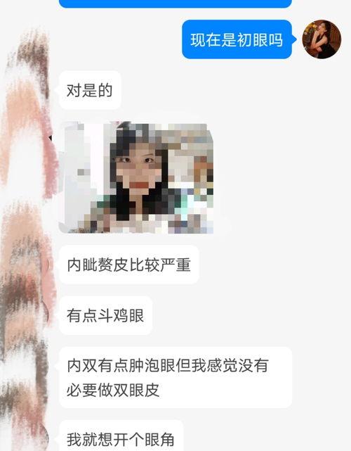 不做提肌只割双眼皮的后果？ 提肌无力双眼皮多少钱