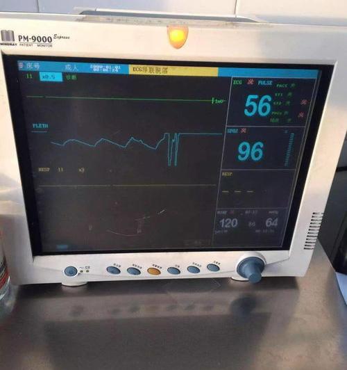 心电监护仪pl是什么？ 心电监护仪怎么看