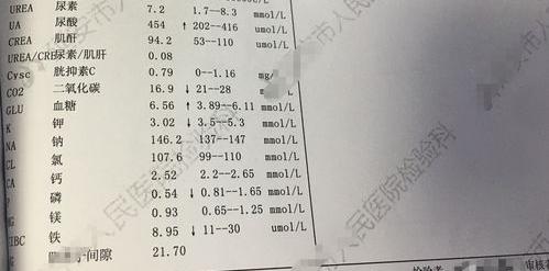 CREA,TP,ALT,ALB,BUN,CREA和有关血检的英文简写在医学中是什么意思? 胆碱酯酶英文缩写