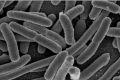 多重耐药大肠杆菌菌株与健康肠道中的细菌作斗争
