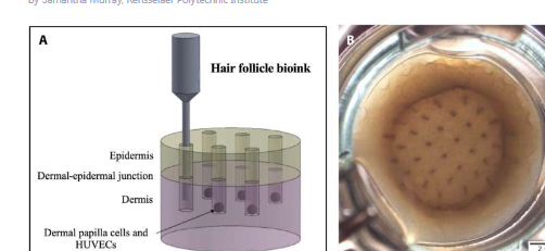 科学家在实验室培育的皮肤上3D打印毛囊