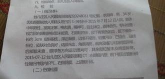 故意伤害轻伤一级赔偿多少钱？ 轻伤一级赔偿多少钱