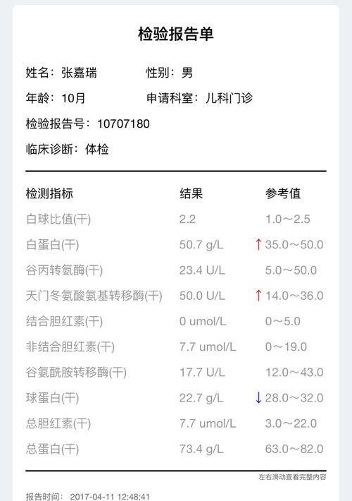 天冬氨酸氨基转移酶偏高的原因 天冬氨酸氨基转移酶高是什么原因