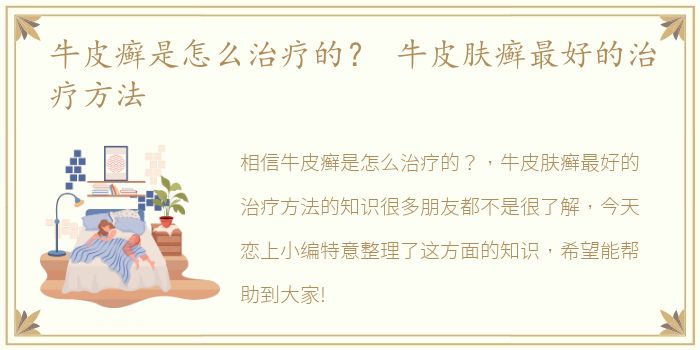 牛皮癣是怎么治疗的？ 牛皮肤癣最好的治疗方法