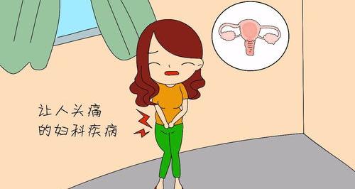 女性普遍有哪些妇科病 常见妇科疾病有哪些