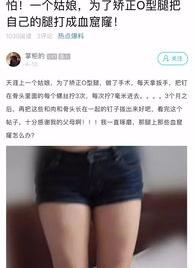 弱弱问个问题，有没有人可以告诉我O型腿可以矫正过来吗？ o型腿做了手术后悔了