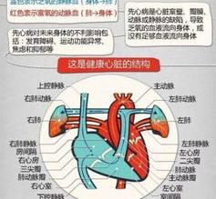 先天性心脏病家庭护理 先天性心脏病最怕什么