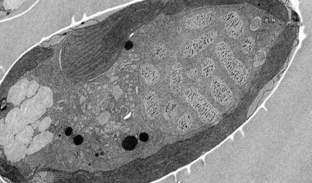 具有异常细胞生物学的微藻可以提高对有害藻华的了解