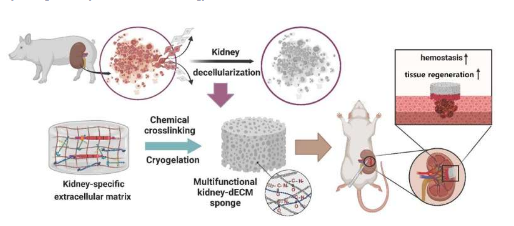研究团队开发多孔海绵材料增强肾脏止血和修复