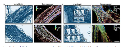 混合成像方法以 3D 形式揭示微生物