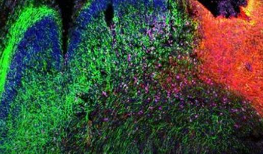 3D多组学为人类大脑发育研究增添深度